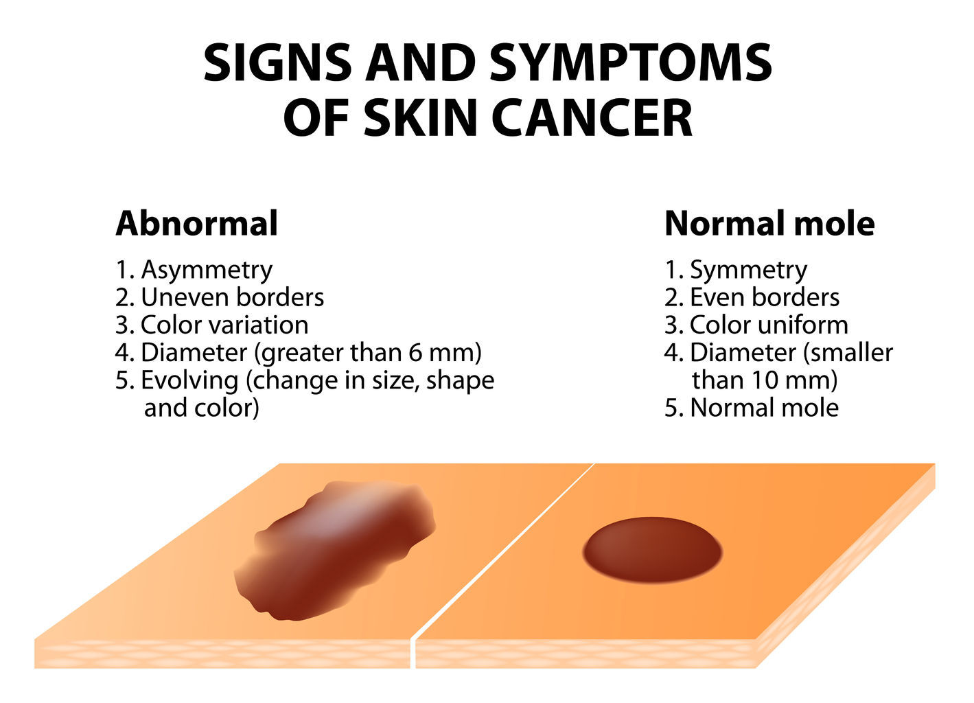 Skin Cancer Treatments in Los Angeles