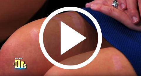 Watch The Doctors Show clip of Laser Hair Removal gone wrong