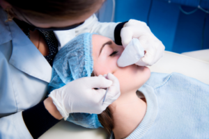 Common Acne Treatments